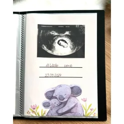 Personalisiertes Ultraschallbilder Album – Einsteckalbum zur sicheren Aufbewahrung und Geschenkidee