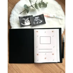 Personalisiertes Ultraschallbilder Album – Stabiles Einsteckalbum zur Aufbewahrung & Geschenkidee