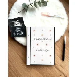 Personalisiertes Ultraschallbilder Album – Stabiles Einsteckalbum zur Aufbewahrung & Geschenkidee