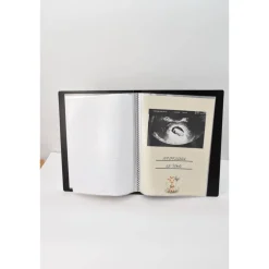 Ultraschallalbum personalisiert,  zur Aufbewahrung von Ultraschallfotos, Ultraschallbilder Mappe, Geschenk zur Geburt