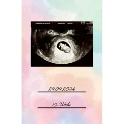 Ultraschallbilder Mappe Album für Ultraschallbilder personalisierbares Einsteckalbum stabiles Aufbewahrung