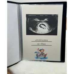 Ultraschallbilder Mappe Teddybär – personalisiertes Ultraschallalbum zur Aufbewahrung deiner Ultraschallbilder